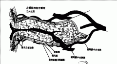 7、视乳头血管炎